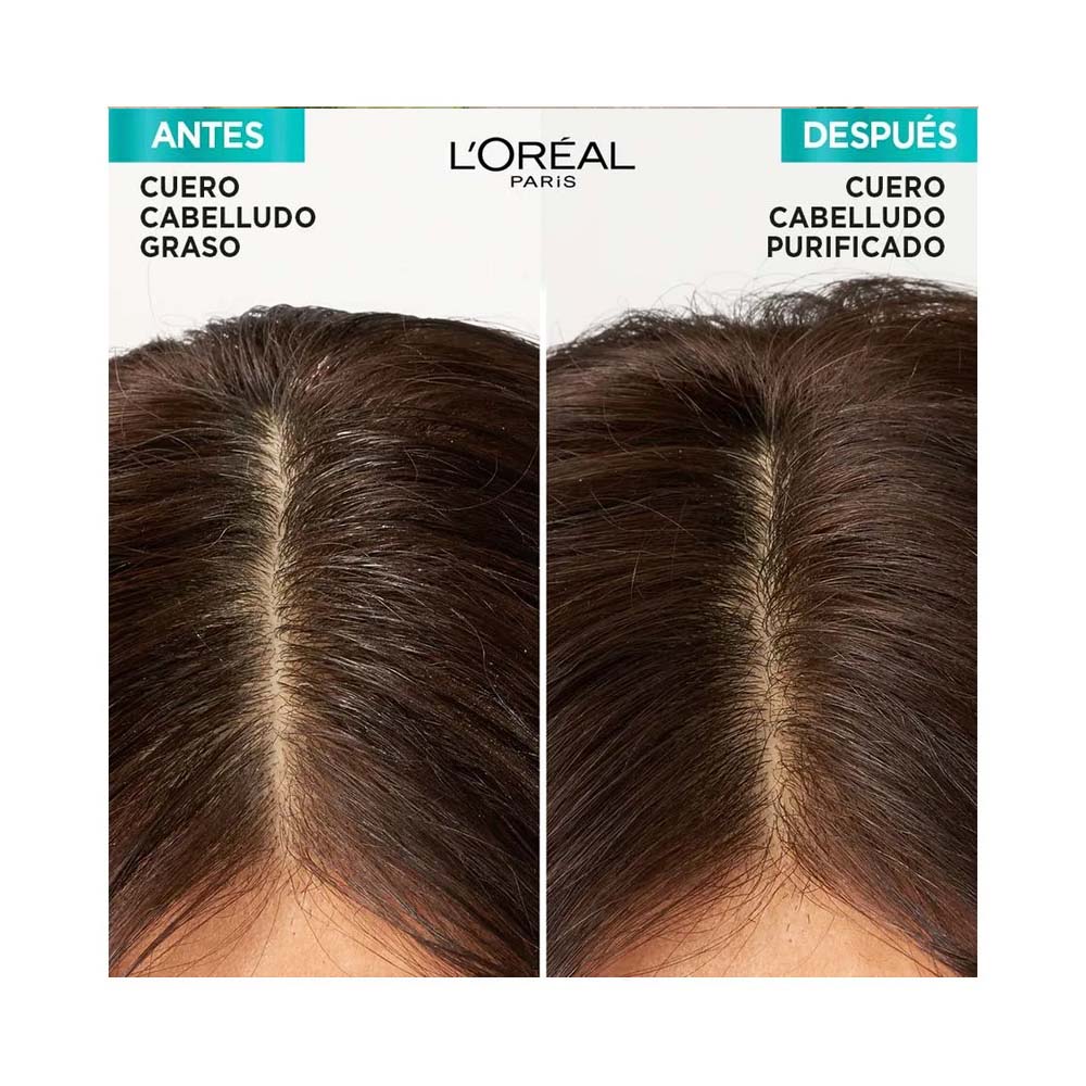 Acondicionador Hidra Equilibrante Hialuronico Pure 750 Ml Elvive